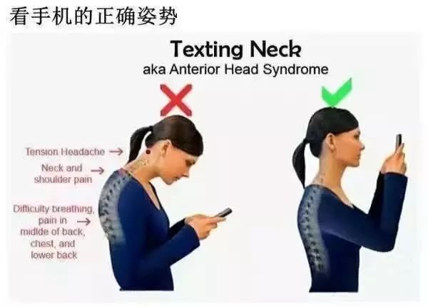 骨科医生颈椎变直怎么办,颈椎曲度变直要看什么科