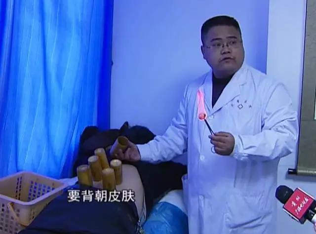 拔火罐烧伤的明星,明星拔火罐烧伤