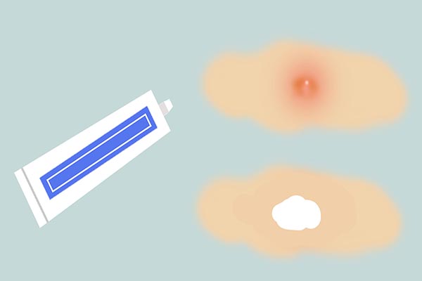 皮肤突然出现小红点怎么回事,肝病患者皮肤出现小红点发痒