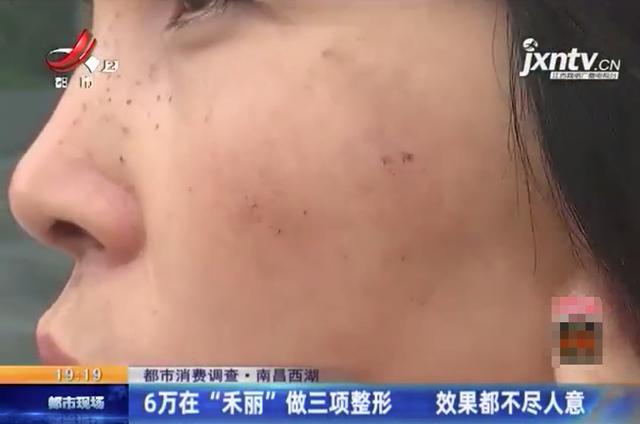 “我是来变美的！”女子花6万在“禾丽”做整形效果竟这样？