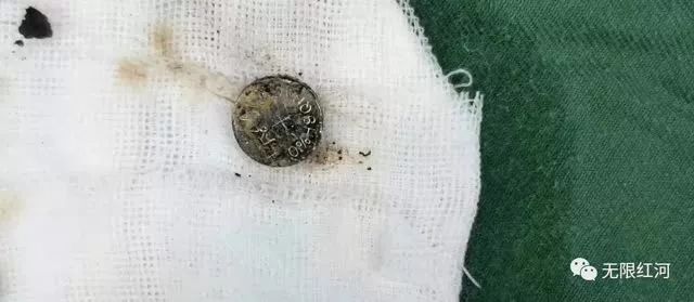 喝了爸爸一碗粥，一岁多孩子肠穿孔..医生曝光原因让所有人震惊