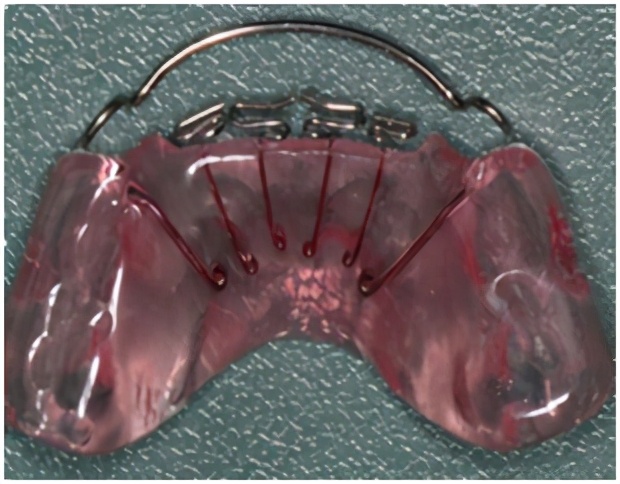 孩子嘴巴地包天有什么说法吗,小孩嘴地包天