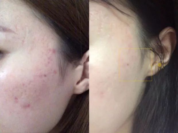 医美同康黄金面膜真的假的,医美面膜真的特别好吗