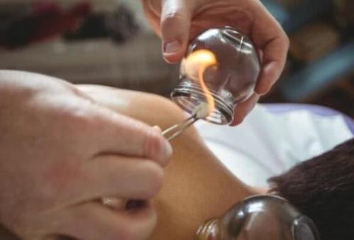 拔罐黑是有瘀血吗,拔罐要怎么才能更好拔出黑印