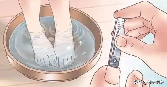 指甲也能剪出错？甲沟炎找上门痛不欲生！这才是剪指甲的正确方式