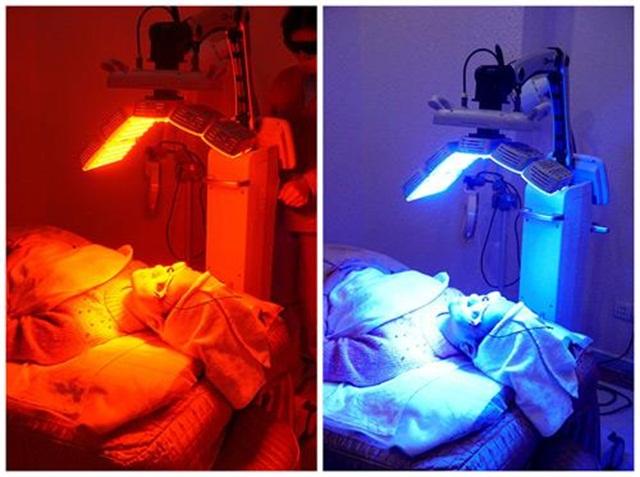 为什么痘印祛不了,为什么痘印去除不了