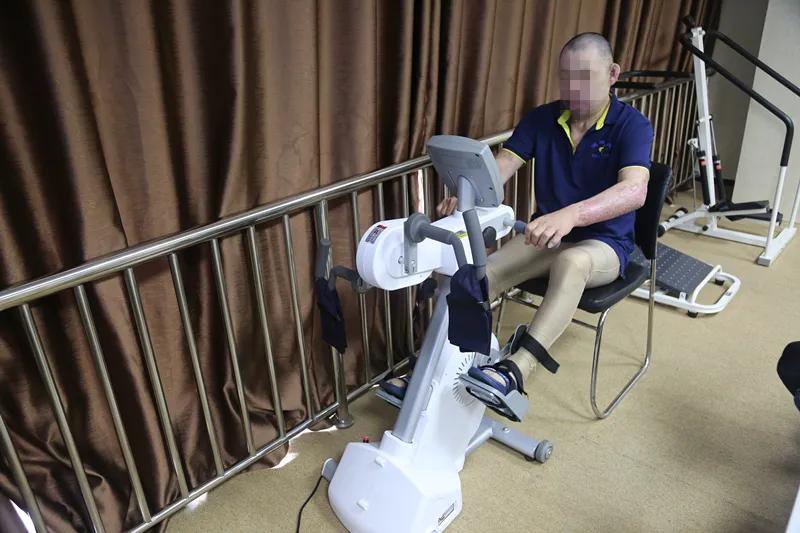 江苏省人民医院烧伤康复中心,医院烧伤康复患者