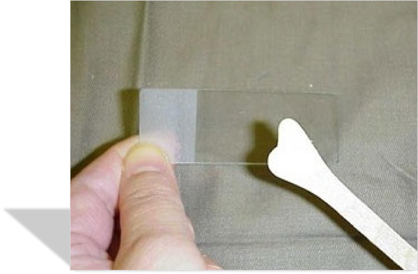 宫颈病变的诊断与治疗科普,宫颈低度病变如何治疗