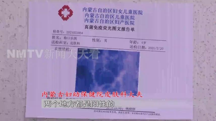 呼和浩特一女子花1500元买了只小猫，几天后孩子身上竟出了红疹？！女子投诉猫舍职能部门介入