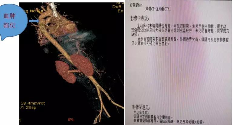 护士巡视病房中发现患者意识不清,护士巡视病房发现患者面色苍白