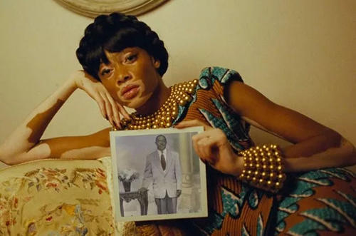 白癜风不扩散好治疗吗,白癜风不扩散可以不治疗么