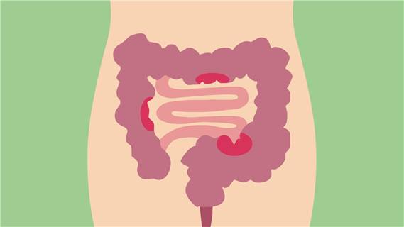 肠道上长溃疡是怎么回事,肠道上有溃疡能自愈吗