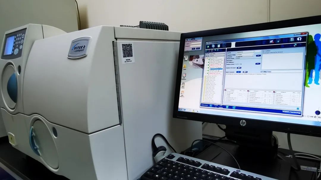 小腹痛、白带脓性,先看看这个检查