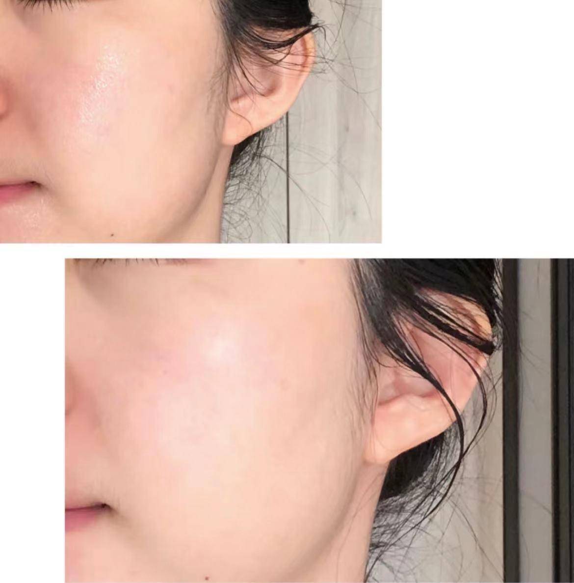 换季皮肤泛红面膜,换季期的面膜推荐