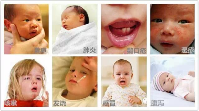 宝宝黄疸湿疹便秘怎么办,小婴儿鹅口疮腹泻湿疹