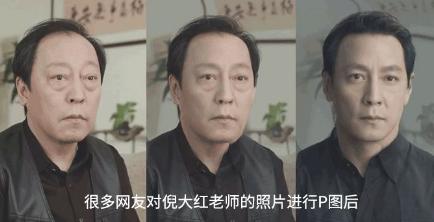 不手术也能去眼袋吗,不开刀去眼袋手术的原理是什么