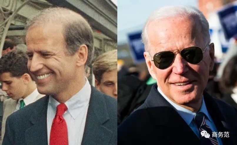 威廉王子秃顶了哈里为啥没秃顶,威廉王子为什么喜欢秃顶