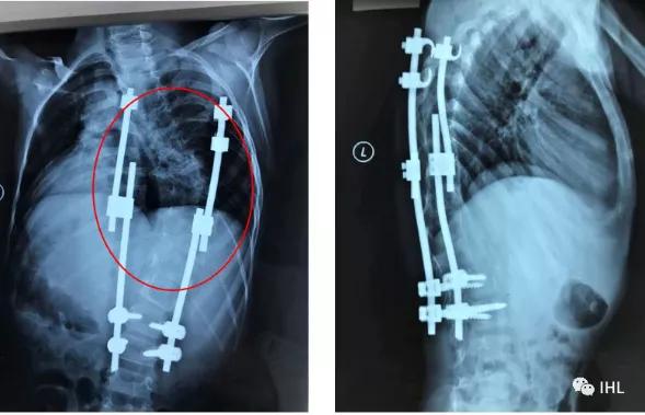 美国顶尖小儿骨科专家——DavidRoye教授已到我院工作