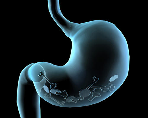 胃像刀剜一样疼,胃痉挛和胃脘痛