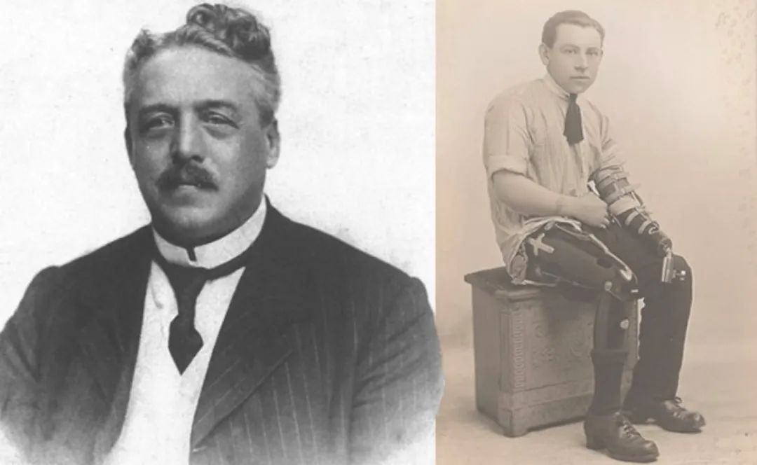 布莱齐福德假肢在中国代理商,德国假肢品牌大全