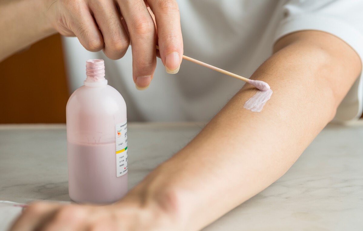 冬天皮肤痒怎么办,医生冬天皮肤痒最快解决方法