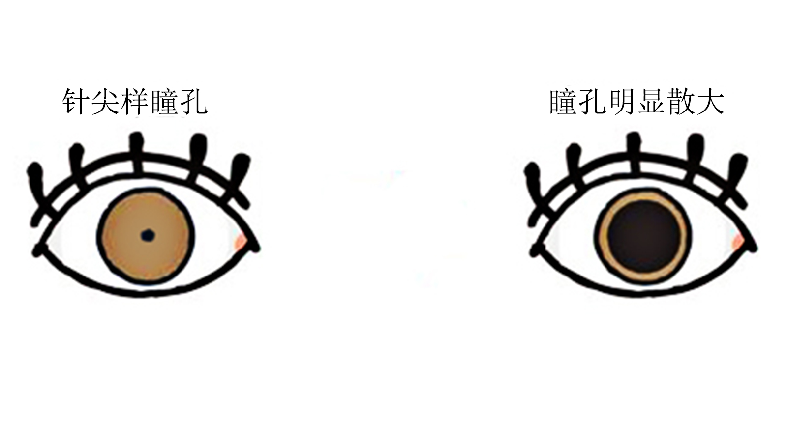 喝酒喝到进医院输液,喝酒喝到去医院输液