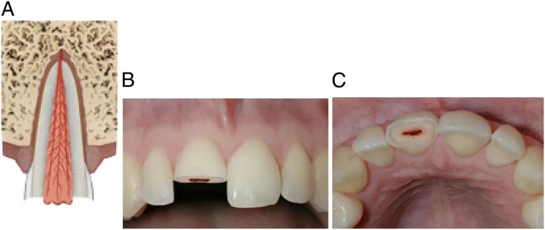 宝宝磕掉乳牙还能再长吗,宝宝磕掉牙会长出来吗