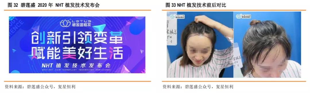 星研究,医疗美容植发四大龙头