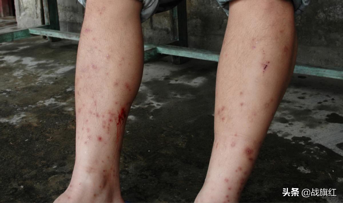 水牛深受蚂蟥之害,大学生好心涂敌敌畏,不料水牛中毒身亡