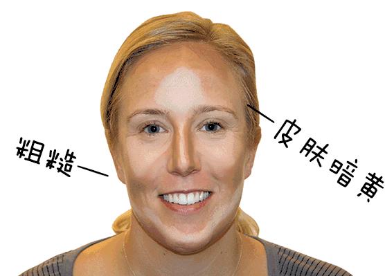 明星都在做的医美,光电光子嫩肤