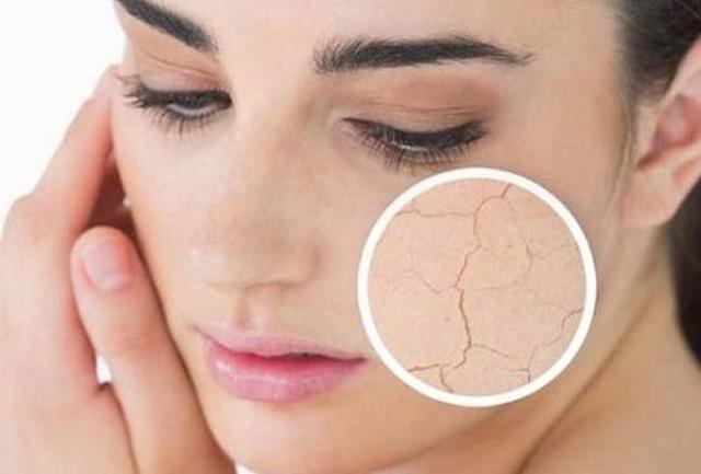 开空调房间太干燥加湿器有用吗,空调制热干燥需不需要买加湿器