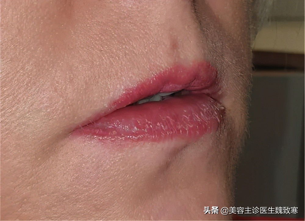 韩式纹眉有哪些种类,韩式纹眉痛吗