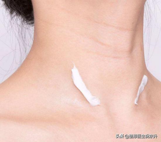 颈纹可以用颈纹霜去除吗,你的颈纹在哪里