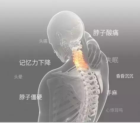 躺着就能治疗颈椎不适？广州这个“高科技”太惊奇了