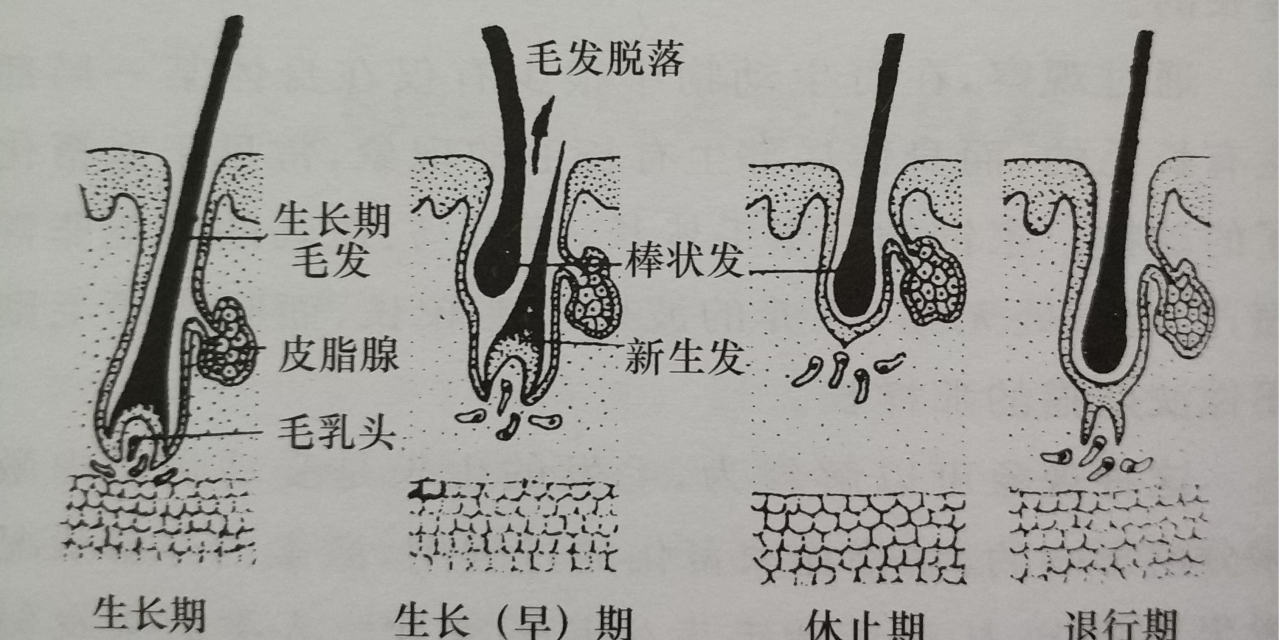 脱毛永久不再长是真的吗,专家科普永久脱毛
