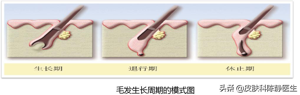 脱发最新研究成果与最新治疗方法,女性脱发严重怎么治疗才有效