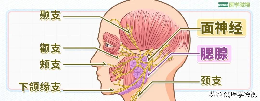 顽固面瘫后遗症自愈经历,一觉醒来半边脸面瘫