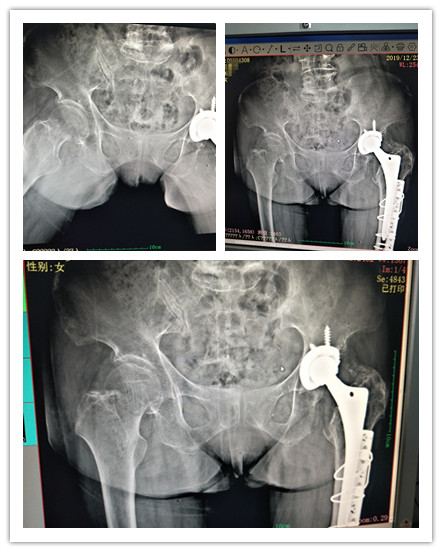 护佑百姓健康，诠释大医精诚—记广州东仁医院外二科团队
