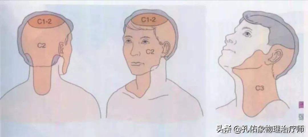 长期头痛头晕是脑出了什么问题,长期头昏头痛怎么办