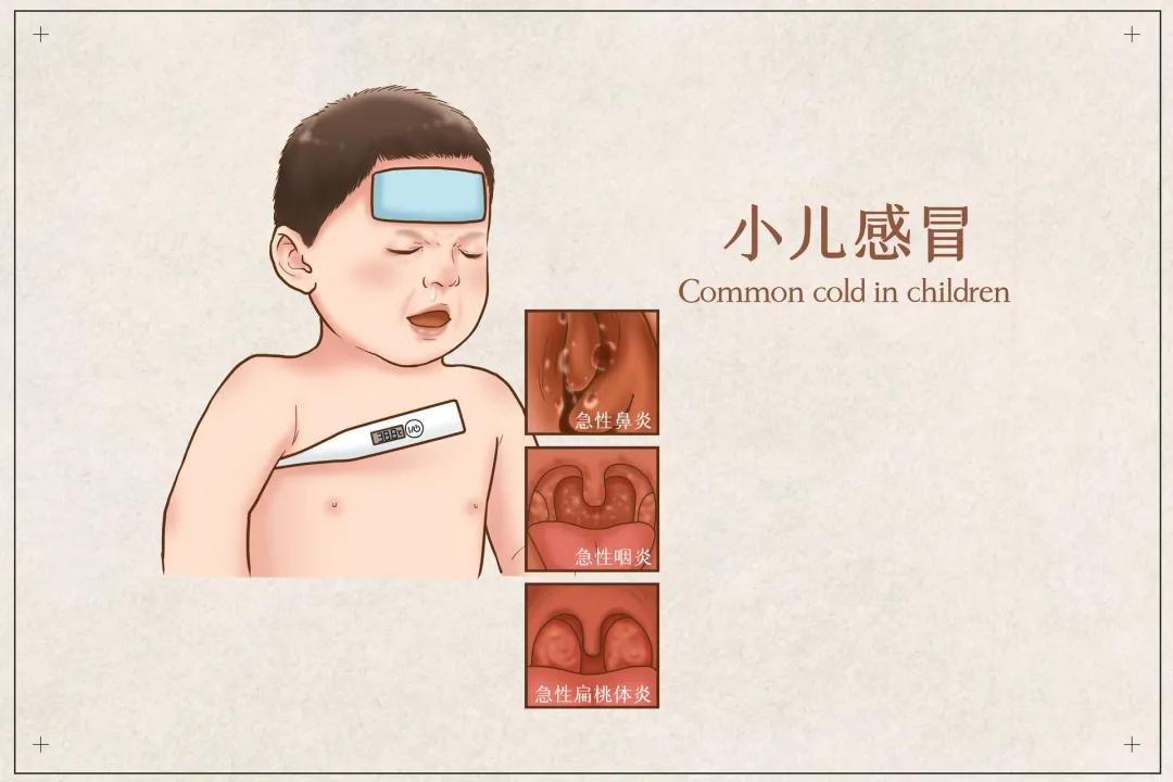 小朋友38度物理降温正确方法,儿童降温最新指南