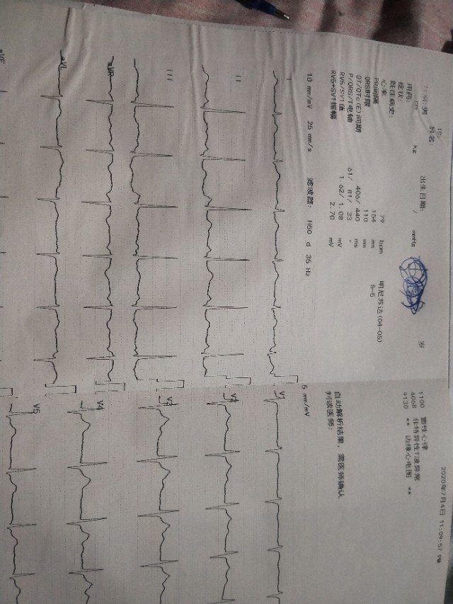 焦虑症治愈者的自述,一名焦虑患者的自救