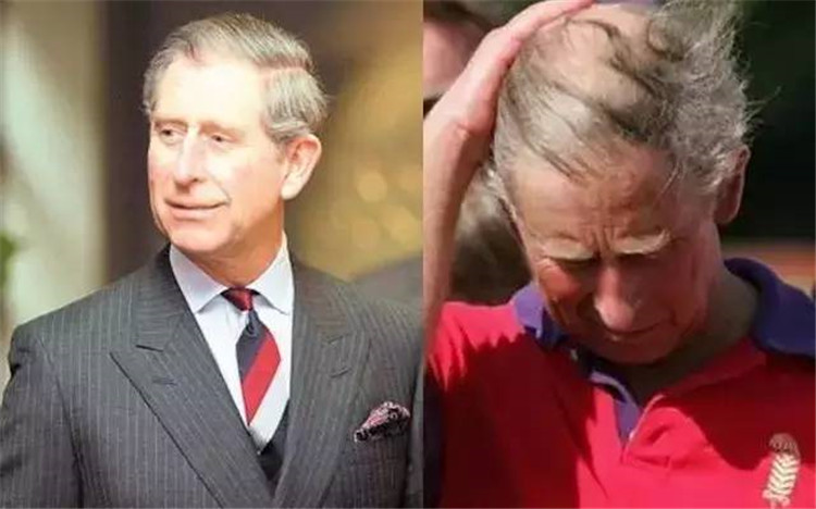 贝克汉姆头秃,贝克汉姆秃了头