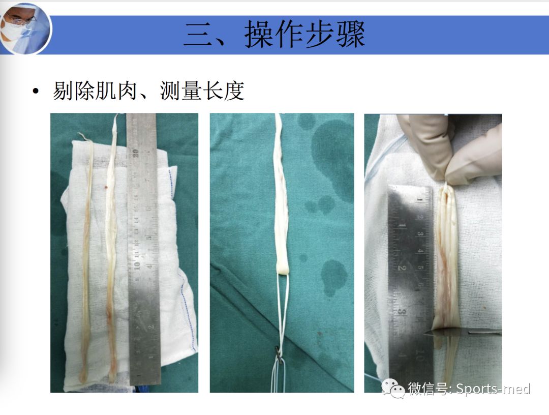 案例分享痴迷足球的十六岁男孩如何战胜十字韧带伤痛重返赛场