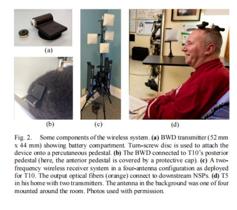 NEJM：全球首例AI+脑机接*技口**术让“失语”瘫痪患者实现沟通自由