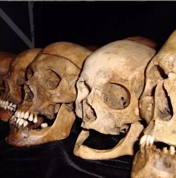 法医根据头骨还原死者,颅骨还原画像原理