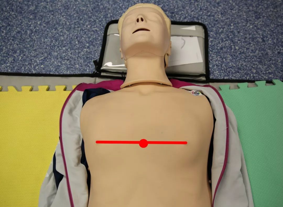 AED入厦三年，90%的厦门人不知，救命神器竟成“摆设”？