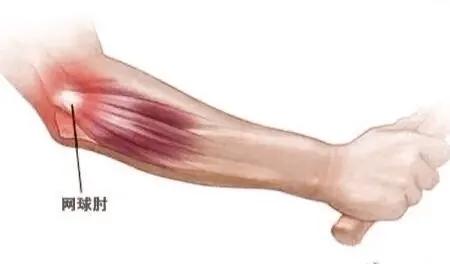 羽毛球业余怎么玩才能玩好,业余羽毛球爱好者注意事项