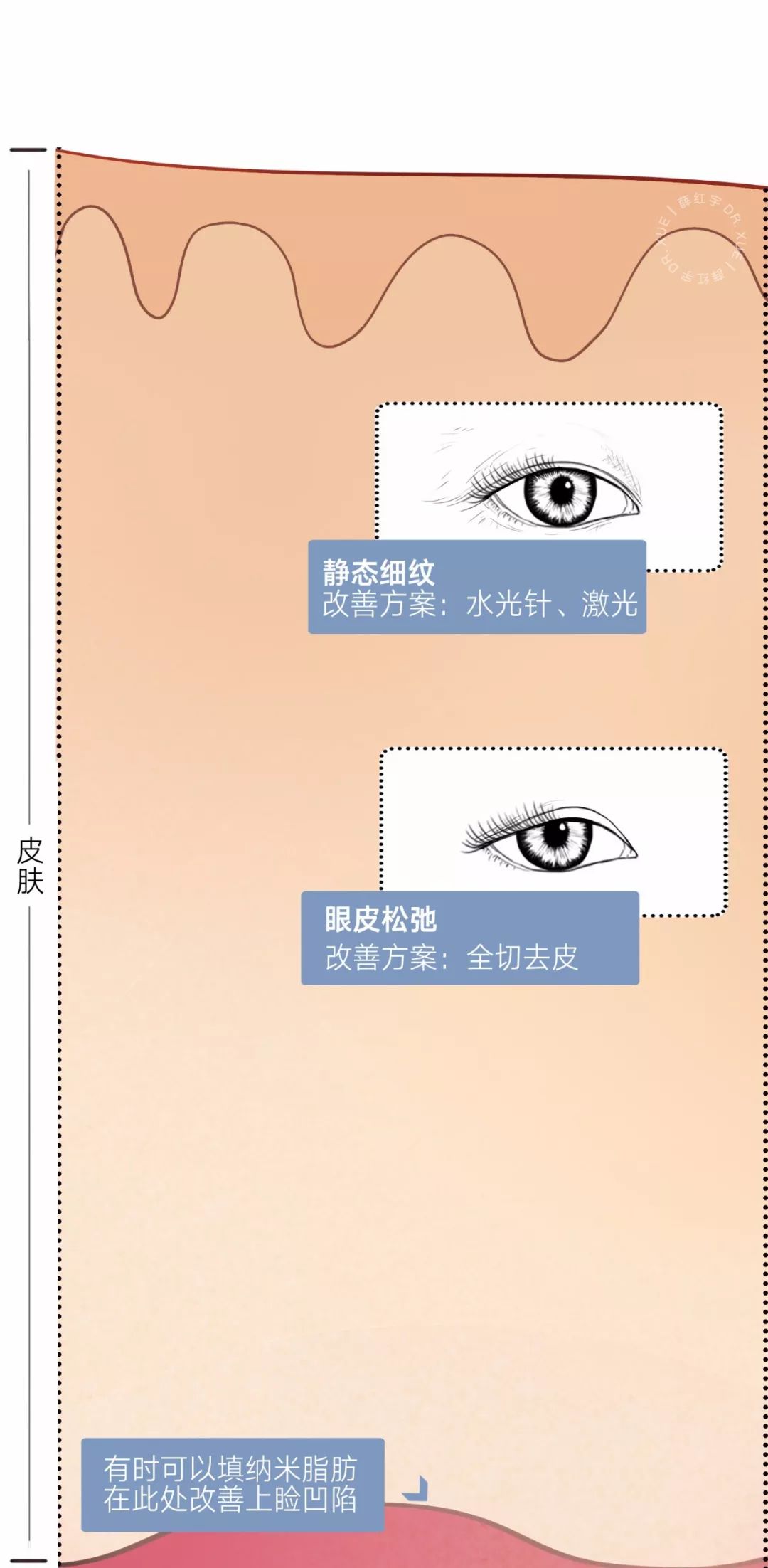 眼睛种类图解漫画,漫画眼睛的几种形态