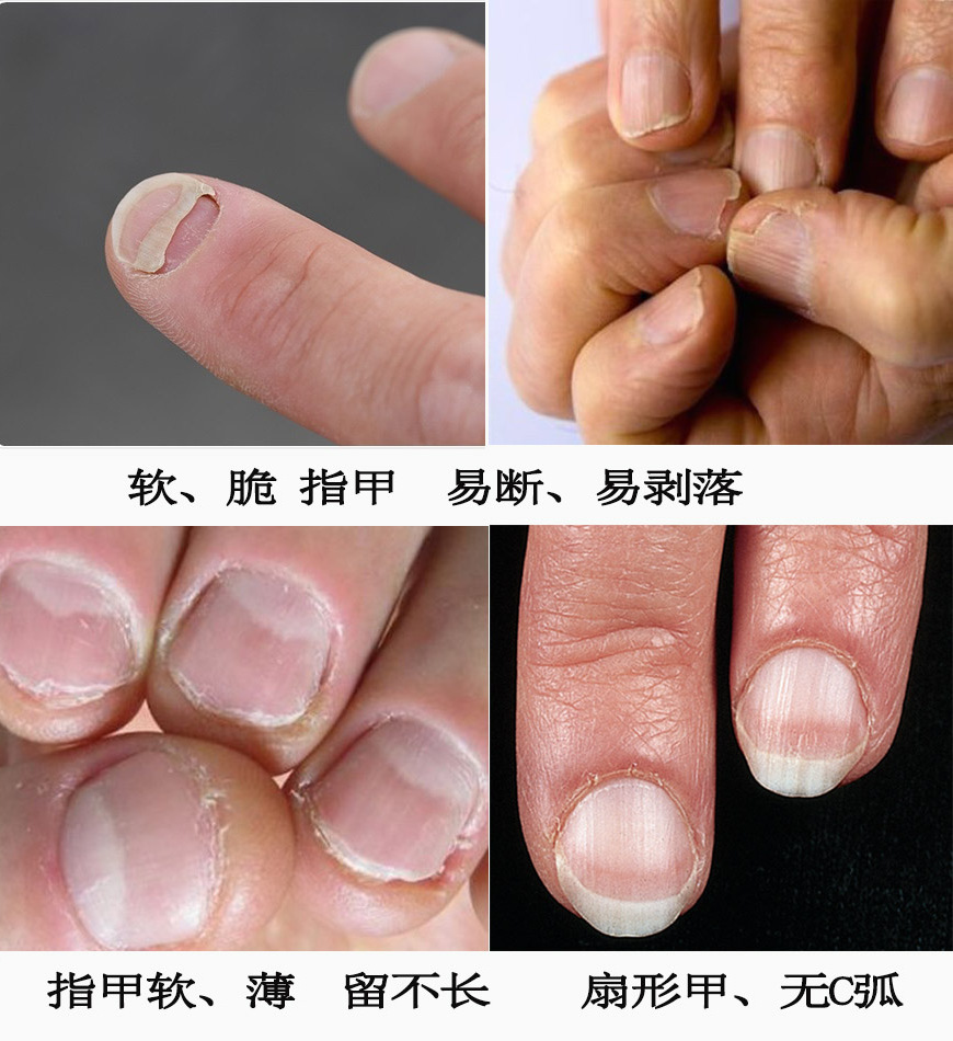 易劈易断还分层？美国专业沙龙修复甲油，给“病甲”快速“整容”