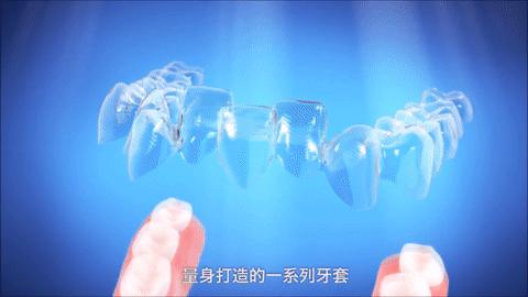 隐型矫正器和固定矫正器的区别,天使隐形矫正与隐适美矫正的区别